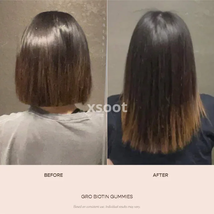 GRO Biotin Gummies for Thinning Hair
