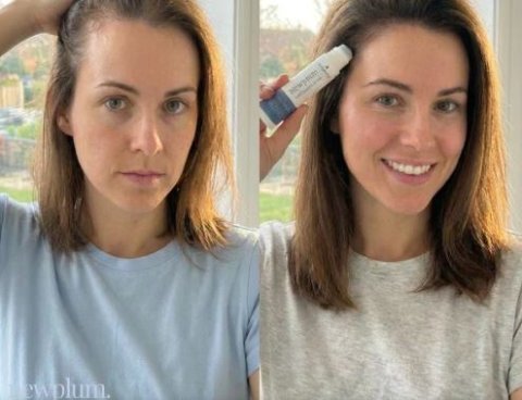 Newplum: Advanced Hair Growth Roll-On Serum