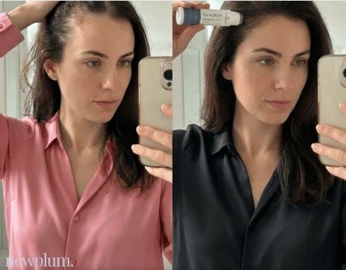 Newplum: Advanced Hair Growth Roll-On Serum