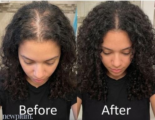 Newplum: Advanced Hair Growth Roll-On Serum