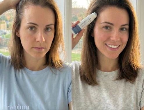 Newplum: Advanced Hair Growth Roll-On Serum